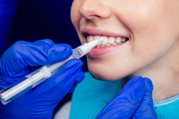 Dentist works on tooth crown in dental laboratory ultraviolet painting teeth with mineral and calcium cream to young red-haired ginger woman.