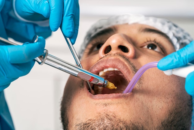 写真 dentist39s 手が歯科医院で患者の口に麻酔を注入します。