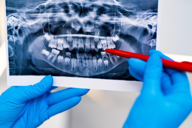 Dentistry xray image examination Teeth healthcare xray treatment