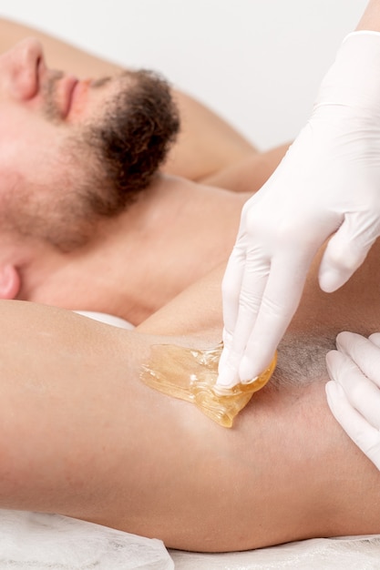 Photo depilation and epilation male armpit with liquid sugar paste. hand of cosmetologist applying wax paste on armpit of man. smooth underarm concept