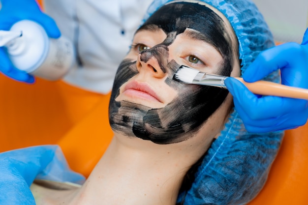 Dermatologist smears black mask on face for laser
photorejuvenation and carbon peeling. dermatology and cosmetology.
using surgical laser.