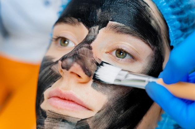 皮膚科医は、レーザー光の若返りとカーボンピーリングのために顔に黒いマスクを塗ります。皮膚科および美容学。外科用レーザーを使用します。