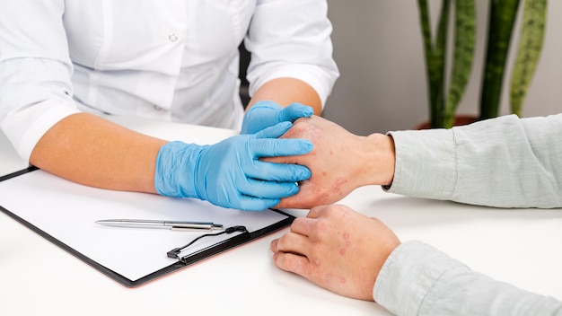 A dermatologist wearing gloves examines the skin of a sick\
patient. examination and diagnosis of skin diseases-allergies,\
psoriasis, eczema, dermatitis.