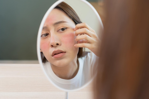 Dermatologia pubertà ragazza asiatica giovane donna che esamina l'allergia allo specchio che presenta una reazione allergica da macchia rossa cosmetica o eruzione cutanea sul viso cura di bellezza dal problema della pelle mediante trattamento medico