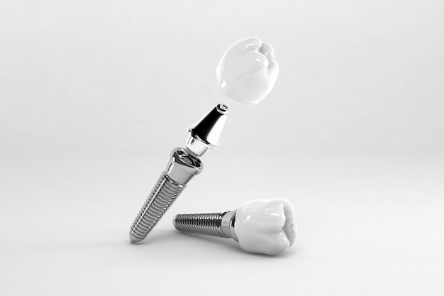 Detail of a false tooth implant; 3D; 3D Illustration