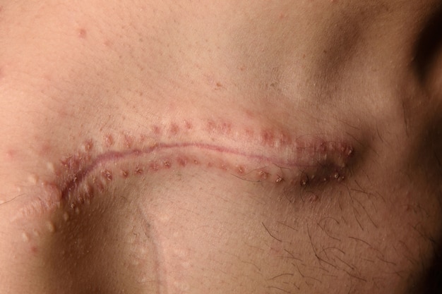 Detail of a scar on the clavicle