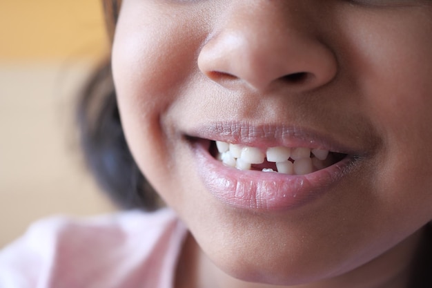 Detail shot of child with teeth missing