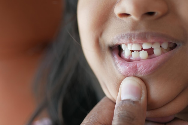 Detail shot of child with teeth missing