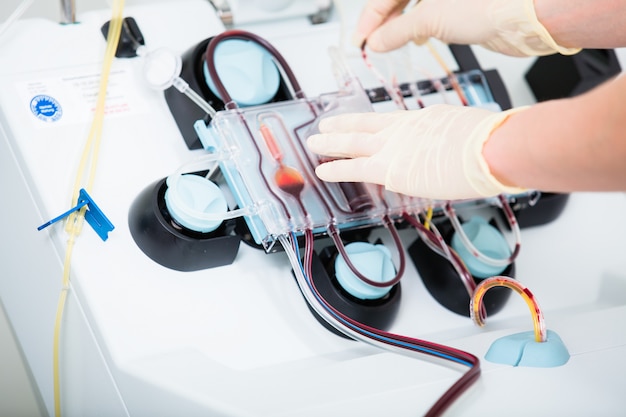 Device for checking blood during blood donations