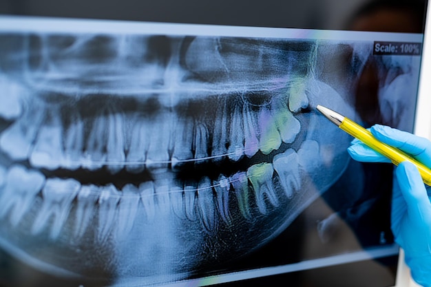 Diagnosing dental modern technologies Professional teeth xray screening