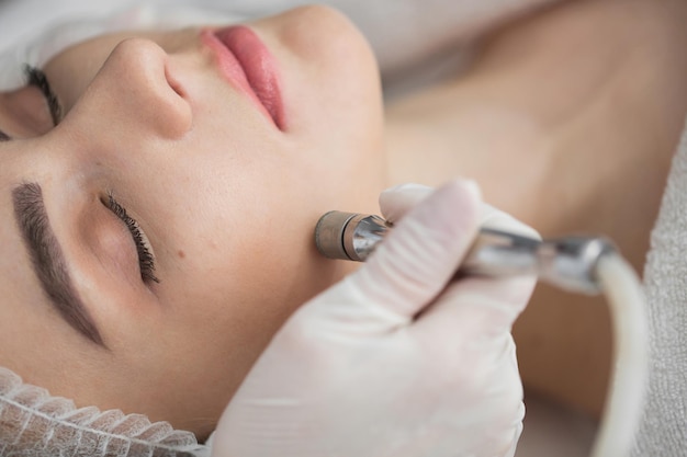 Diamond microdermabrasion peeling cosmetic woman during a microdermabrasion treatment