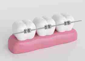 Photo dientes con ortodoncia  3d