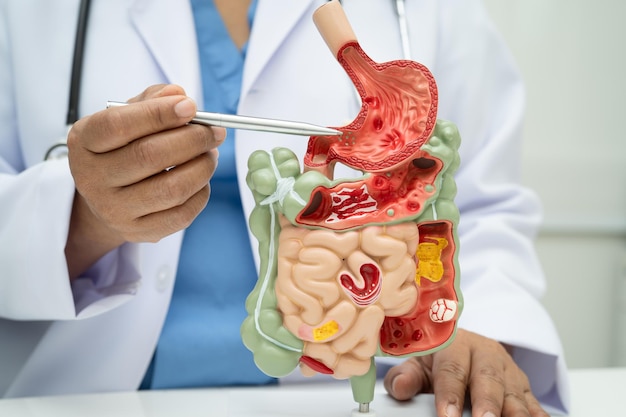 Digestive system with stomach and intestine Asian doctor holding human anatomy model for study diagnosis and treatment in hospital
