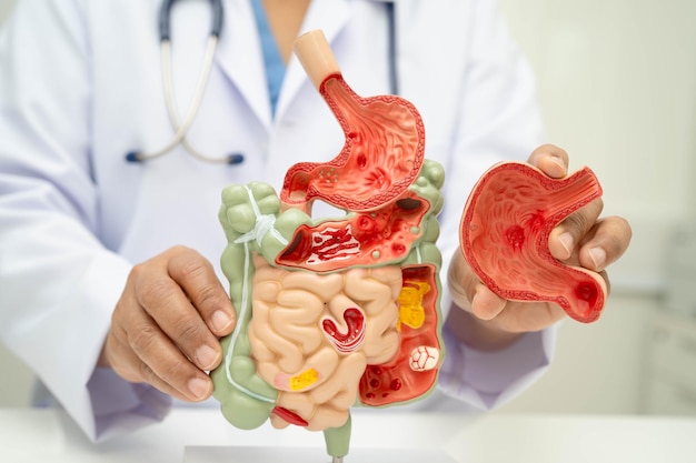Digestive system with stomach and intestine Asian doctor holding human anatomy model for study diagnosis and treatment in hospital