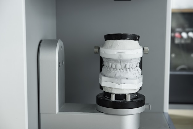 最新の3Dスキャナーでの石膏歯モデルのデジタルスキャン。現代の歯科におけるスマートで完璧なテクノロジー。