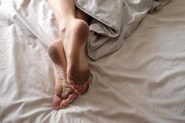 Dirty bare feet of a sleeping person showing out of the blanket