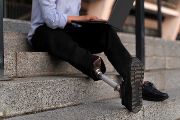 Disabled person with prosthetic leg