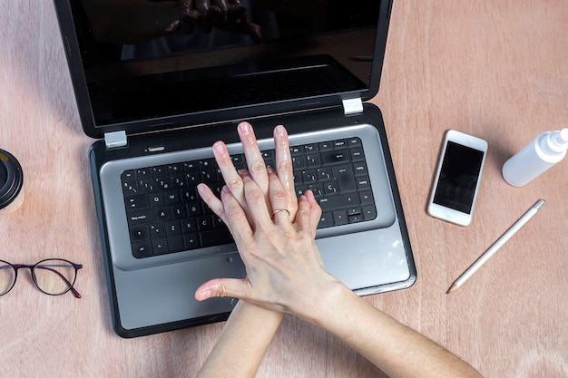 Disinfection of hands with hydrogel on work table