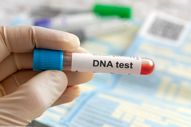 흰색 라벨에 DNA 테스트 글자. 실험실에 있는 의사나 과학자의 손에 있는 DNA 혈액 검사. 유리관에 담긴 혈액 샘플