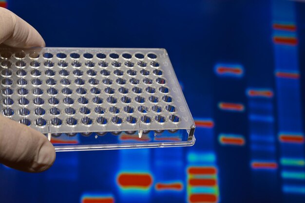 DNA testing in genetic laboratories