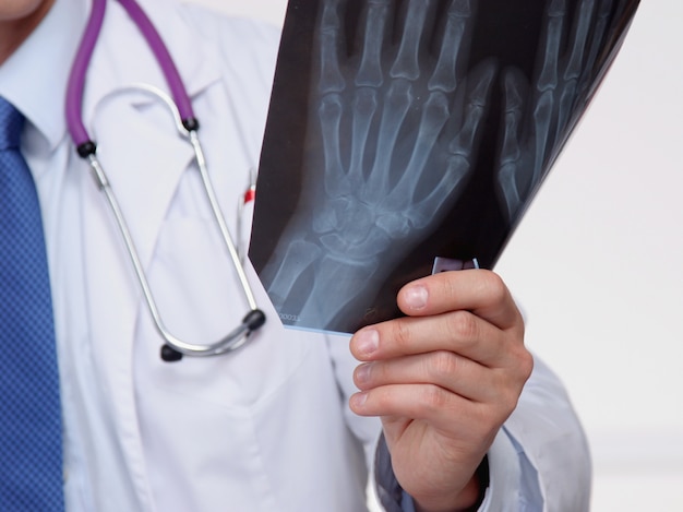 Doctor in blue uniform holding X-rays