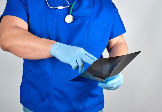Doctor in blue uniform and sterile latex gloves holds and examines X-ray