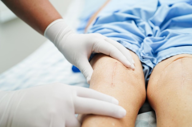 Doctor checking Asian elderly woman patient with scar knee replacement surgery in hospital