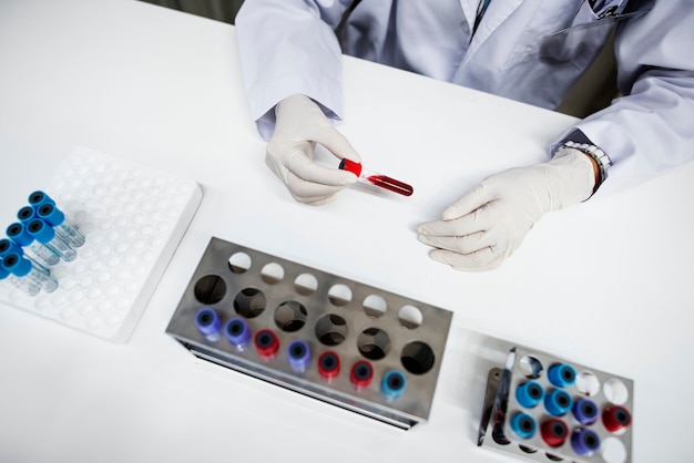 Doctor checking blood samples