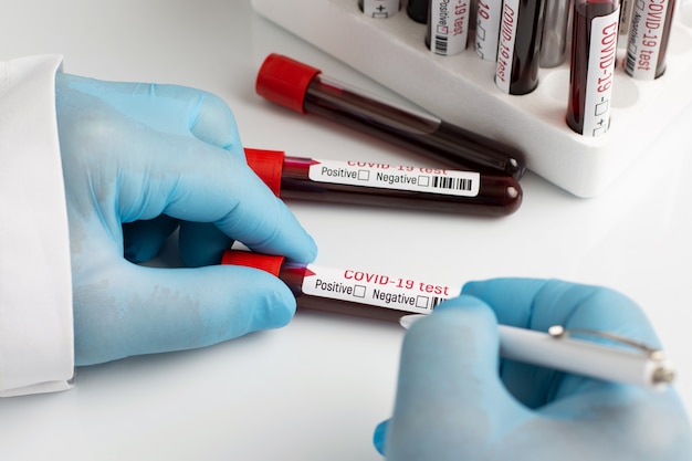 Photo doctor checking coronavirus tests, writing results of the laboratory test on labels of tubes