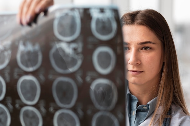 Photo doctor checking x-ray at the hospital