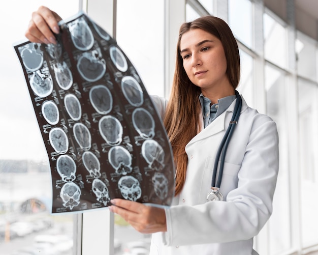 Photo doctor checking x-ray at the hospital