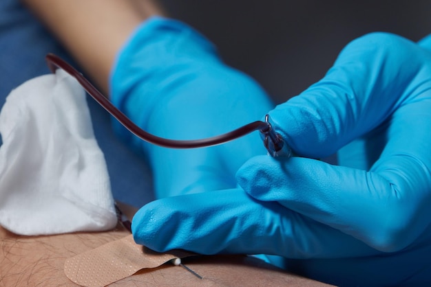 의사는 주사기에 혈액을 수집합니다 간호사는 팔의 정맥에서 혈액을 채취합니다