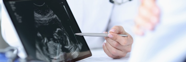 Doctor demonstrates fetal ultrasound on tablet screen medical examination during pregnancy