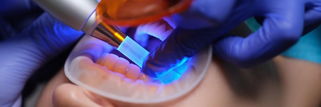 Medico dentista che illumina il riempimento con una moderna lampada a luce in clinica primo piano