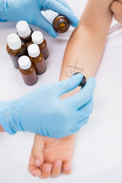 Doctor doing skin prick test at his patient 