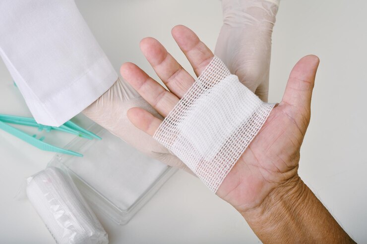 Doctor doing wound dressing care and bandaging patient39s hand Hand surgery treatment Nurse treat patient39s finger injury in hospital