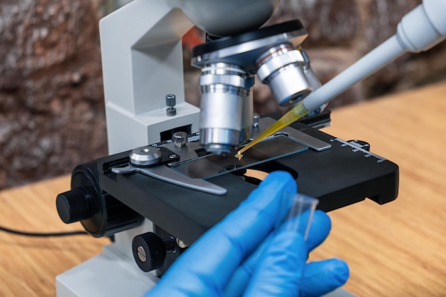 Photo doctor dripping urine from a pipette onto glass under microscope to check for urolithiasis disease