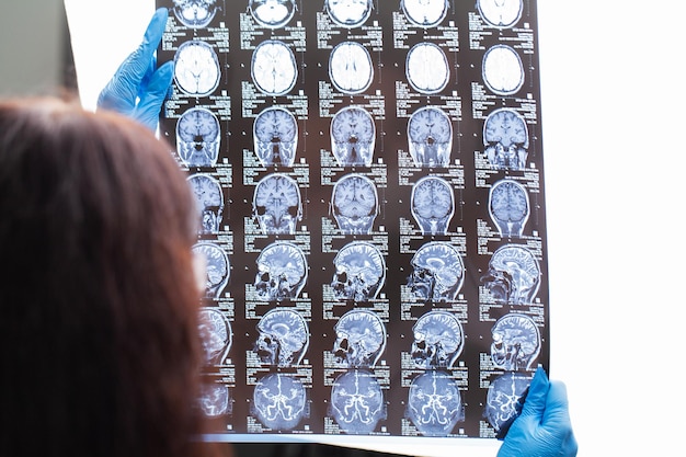 Doctor examines an MRI image of the patient