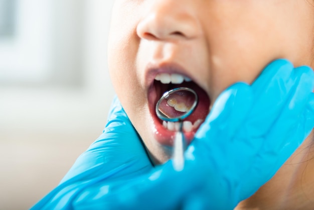 Il medico esamina la cavità orale del bambino piccolo usa lo specchio della bocca per controllare la cavità dei denti