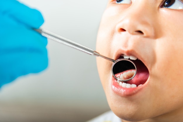 Doctor examines oral cavity of little child uses mouth mirror to checking teeth cavity