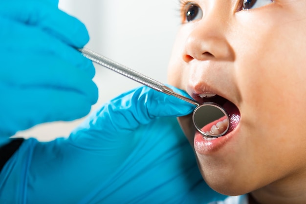 Doctor examines oral cavity of little child uses mouth mirror to checking teeth cavity