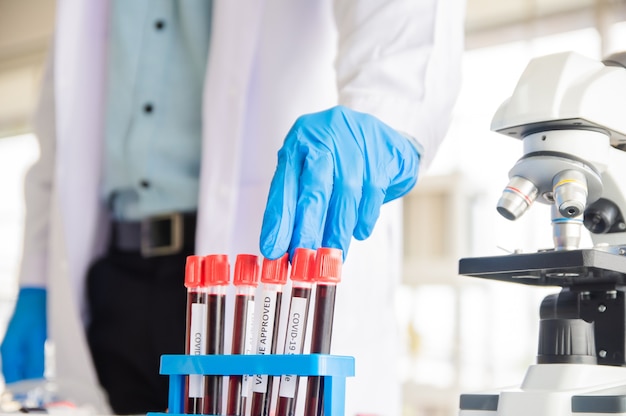 Doctor examines pathogens from blood samples of covid19 patients