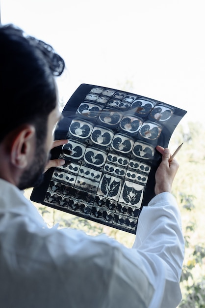 Doctor examines an x-ray on a white