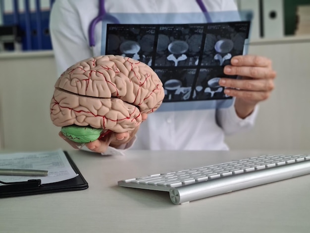 Doctor examines xray of human brain in clinic closeup