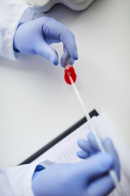 Foto medico che esamina campione di sangue