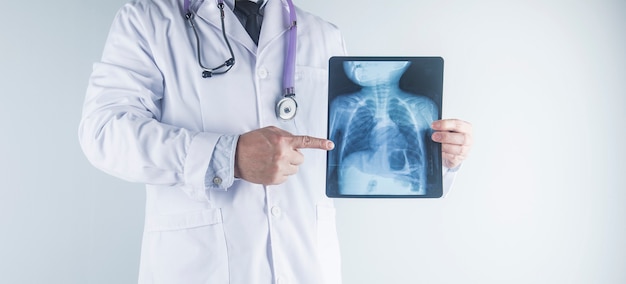 Doctor examining chest x-ray film of patient at hospital.