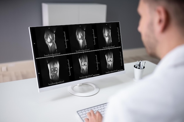 Doctor Examining Knee Xray