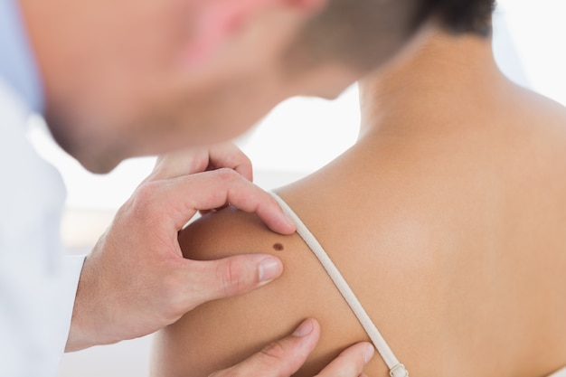 Doctor examining mole on back of woman