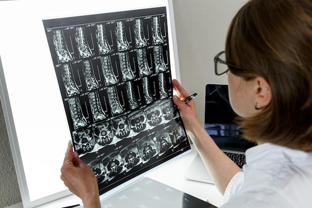 Doctor examining the result of lower spine mri