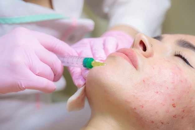 The doctor gives injections of blood plasma into the face of a young girl